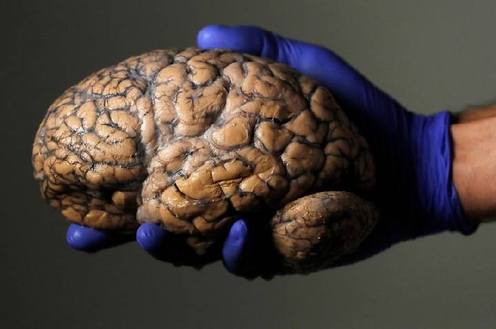 Alguns cérebros humanos não apodrecem: entenda quais são eles e por quê