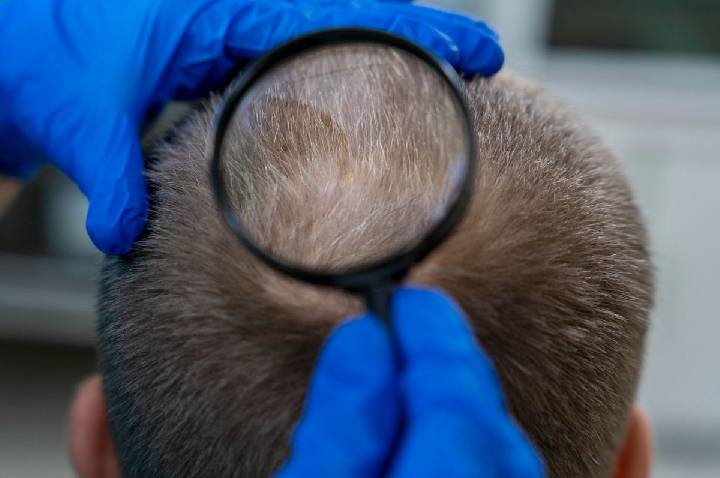 Cabelo não cresce de dentro para fora, mas é puxado para cima, diz estudo