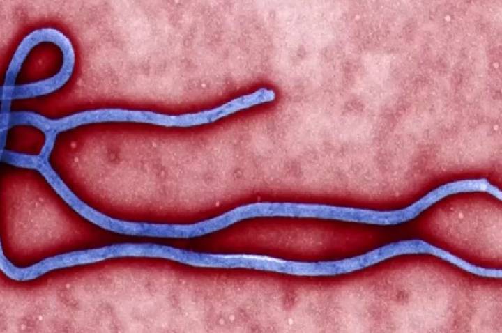 Caso suspeito de ebola é descartado em paciente no Rio Grande do Sul