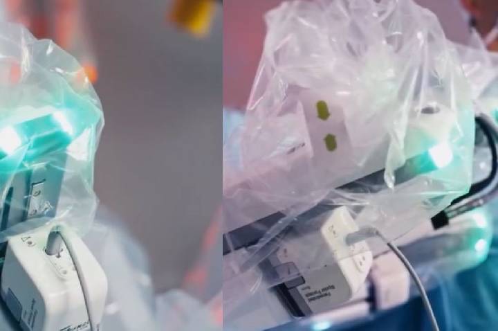 Cirurgia com robô: médico brasileiro na China opera paciente no RS