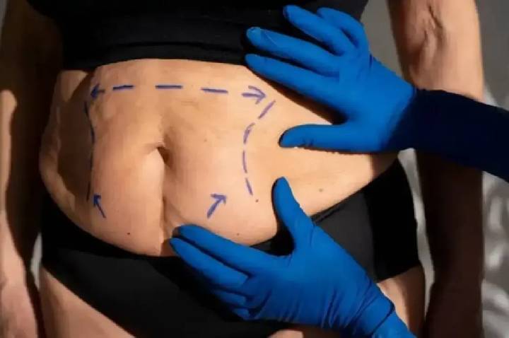 Cirurgia plástica melhora a autoestima mesmo ou é só uma ilusão?