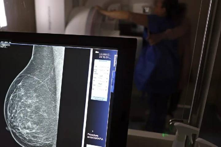 Cobertura obrigatória de mamografia digital para todas as idades