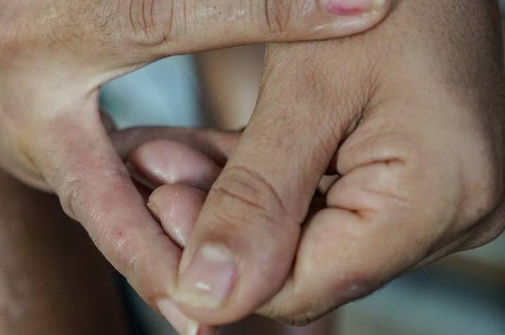 Como a dermatite atópica afeta a pele, o sono e a autoestima: tratamentos disponíveis