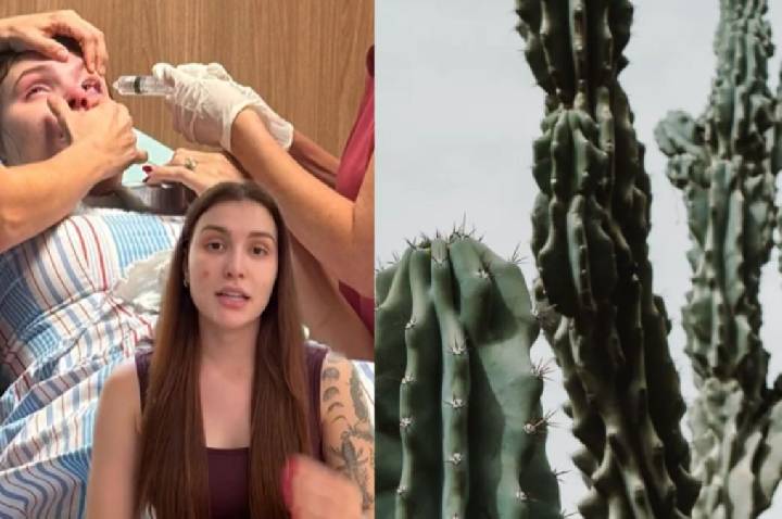 Como evitar acidentes com cactos? Influenciadora teve queimadura nos olhos
