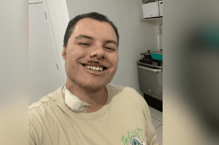 Homem agredido em festa universitária de SP é internado novamente após alta