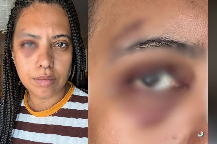 Influenciadora é agredida em samba na região central do Rio de Janeiro