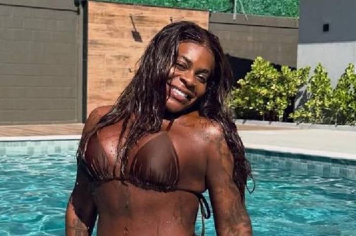 Jojo Todynho mostra cicatriz após retirar excesso de pele das axilas