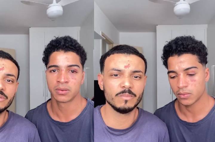Jovens relatam ataque homofóbico após festa universitária no RJ