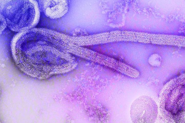 Paciente de Uganda sob suspeita de ebola testa positivo para malária no RJ