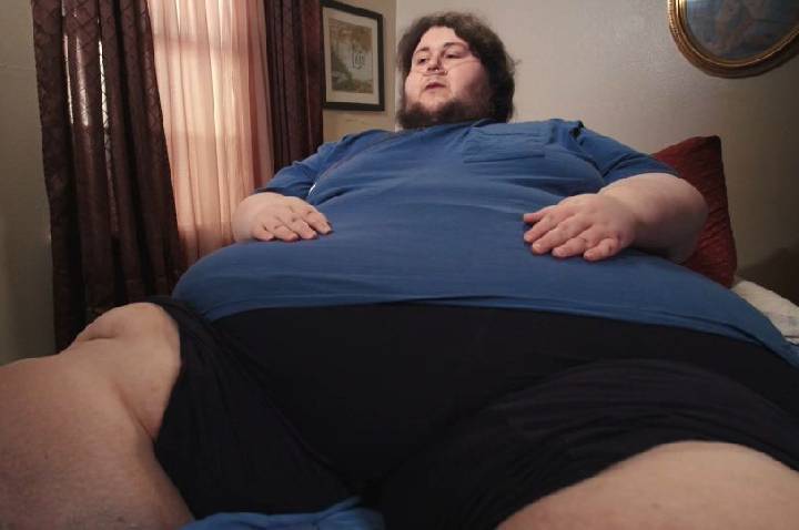 “Quilos Mortais”: relembre a história de Thommy, que pesava 290 kg