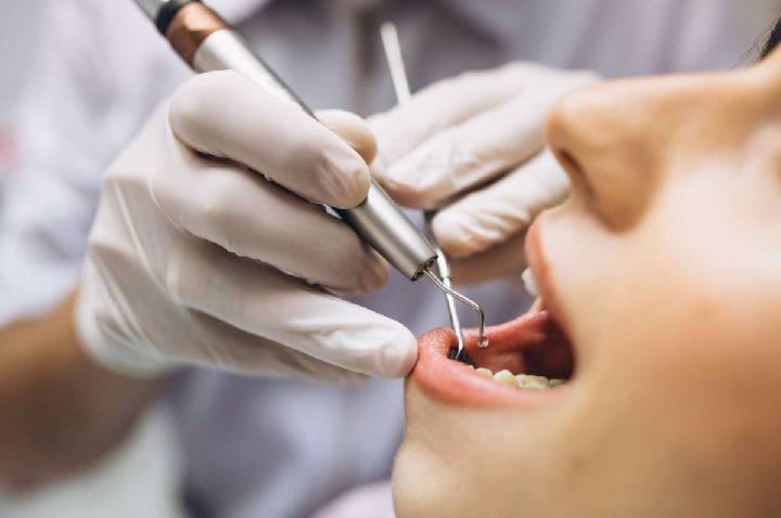 USP desenvolve IA para identificar cárie em radiografias