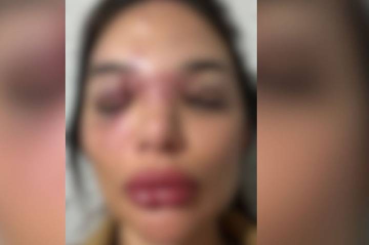 Veja depoimento de mulher agredida por empresário em São Paulo