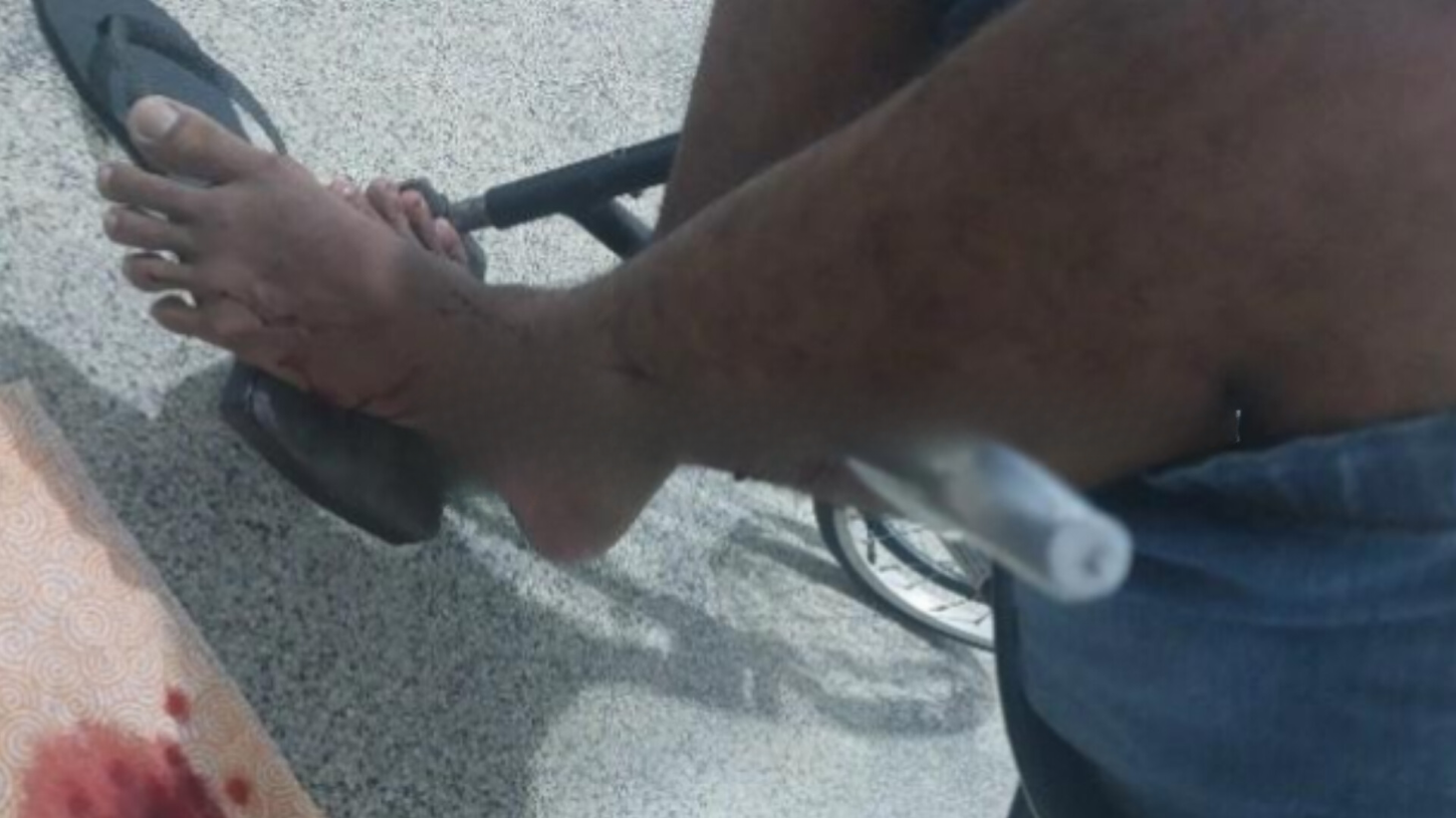 URGENTE: Marido de 30 tem lâmina cravada no corpo pela esposa de 15 anos.