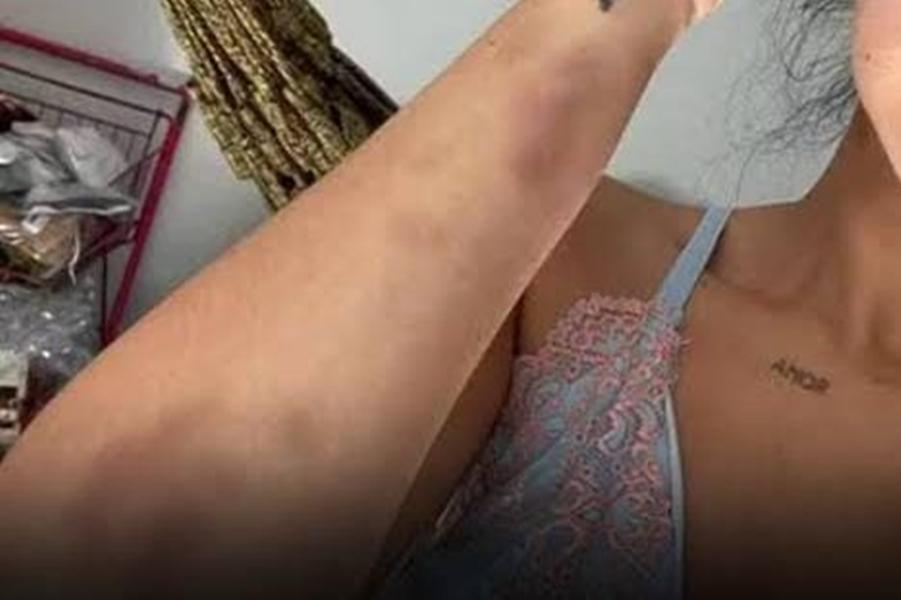 Violência por ciúmes: mulher é agredida pelo namorado após encontro com ex durante festa