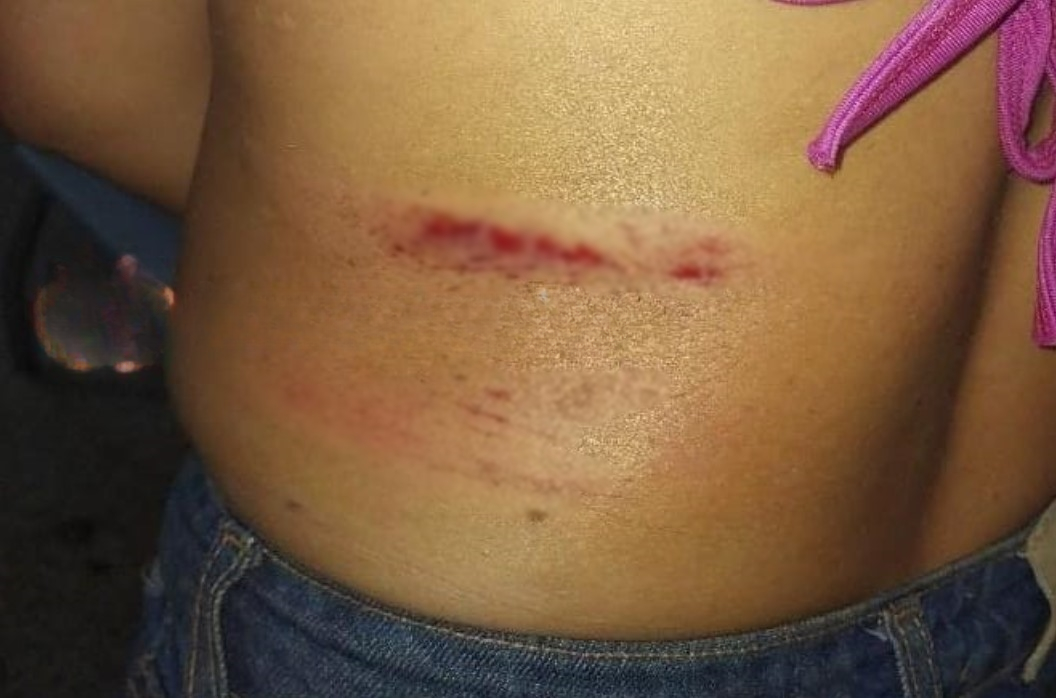 ALTERADO: Mulher é atacada a pauladas pelo sobrinho do marido e vai parar na UPA.
