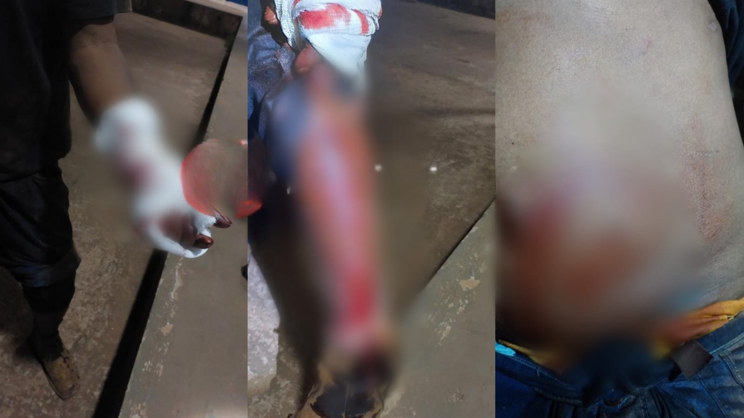 NO BAR: Homem sofre tentativa de homicídio e diz que foi por causa de mulher.