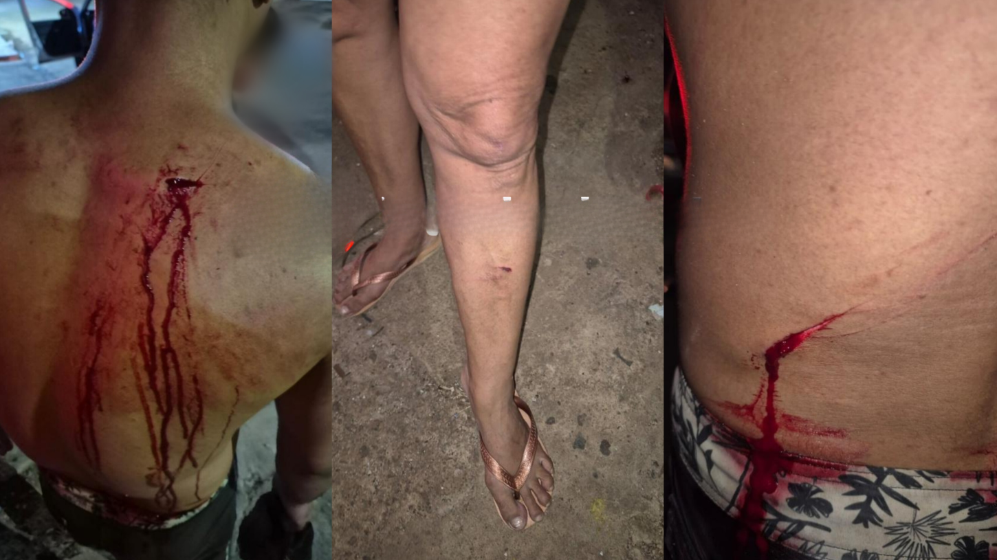 Violência entre vizinhos: mãe e filho são agredidos em vila de apartamentos.