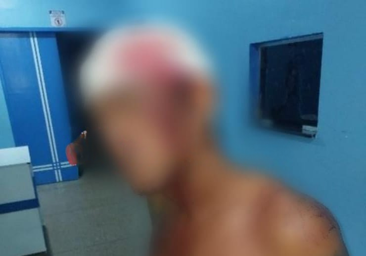 Briga entre vizinhos termina em tentativa de homicídio: homem é agredido na cabeça por trio armado