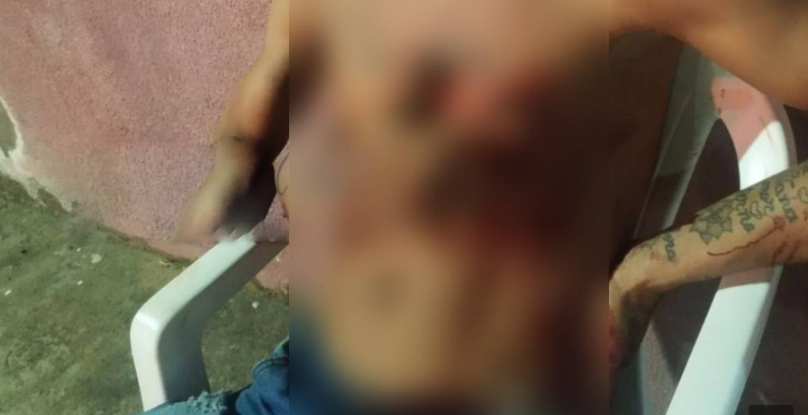 Jovem é esfaqueado em tentativa de homicídio em Ji-Paraná