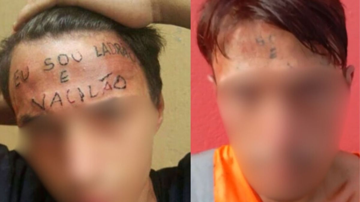 “Ladrão e vacilão”: jovem que teve testa tatuada é preso após roubar UBS