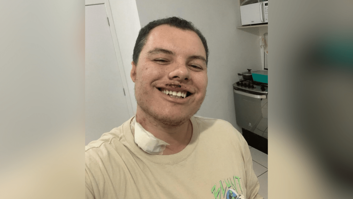 Homem agredido em festa universitária de SP é internado novamente após alta