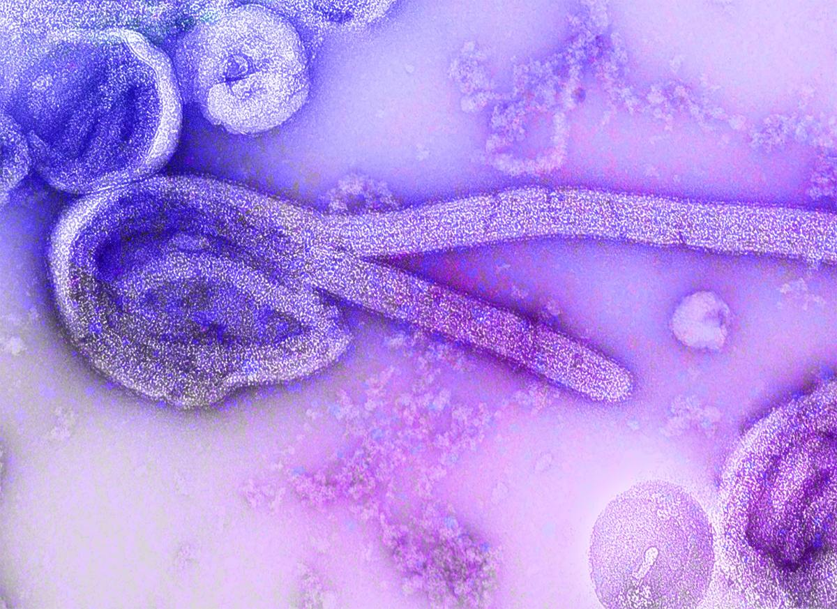 Paciente de Uganda sob suspeita de ebola testa positivo para malária no RJ