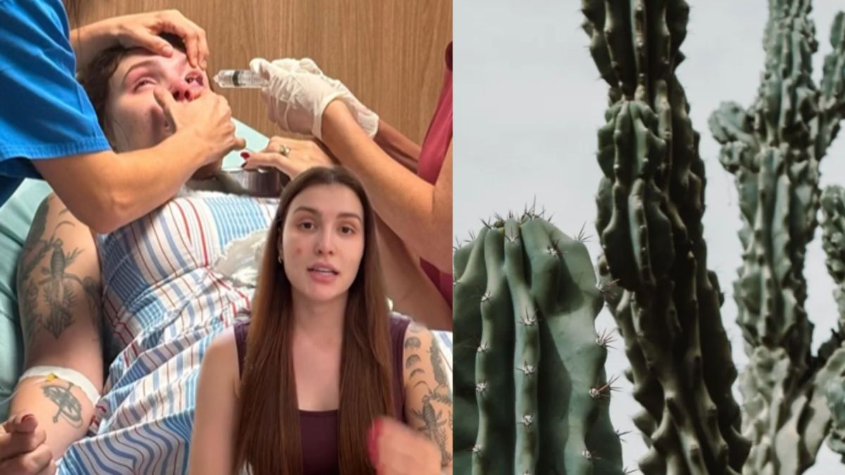 Como evitar acidentes com cactos? Influenciadora teve queimadura nos olhos