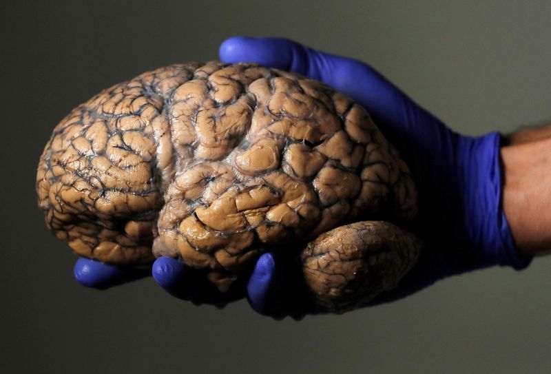 Alguns cérebros humanos não apodrecem: entenda quais são eles e por quê