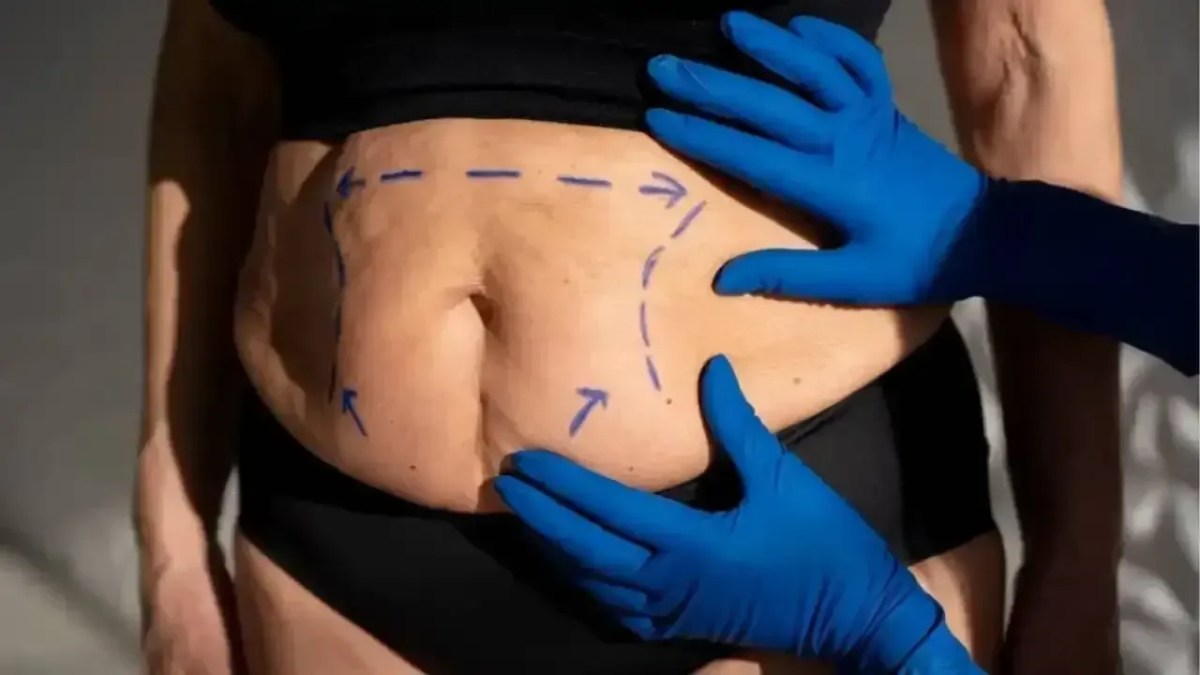 Cirurgia plástica melhora a autoestima mesmo ou é só uma ilusão?