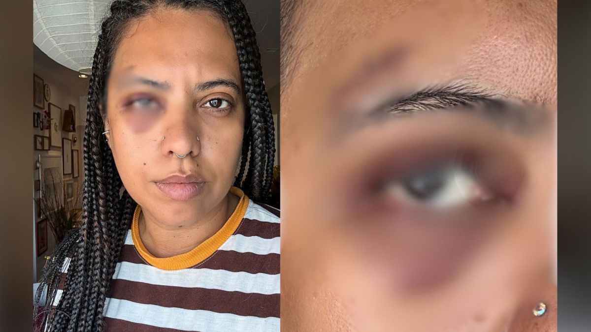 Influenciadora é agredida em samba na região central do Rio de Janeiro