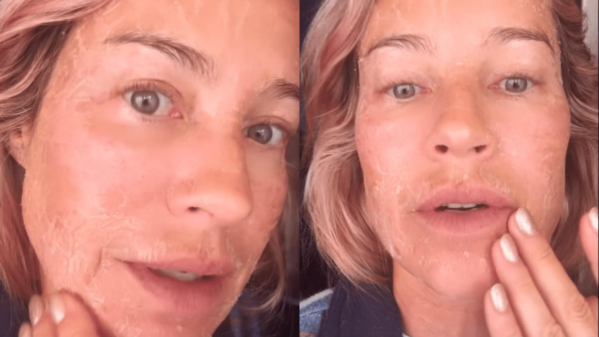 Luana Piovani explica descamação no rosto: “Fazendo 50 com cara de 100”