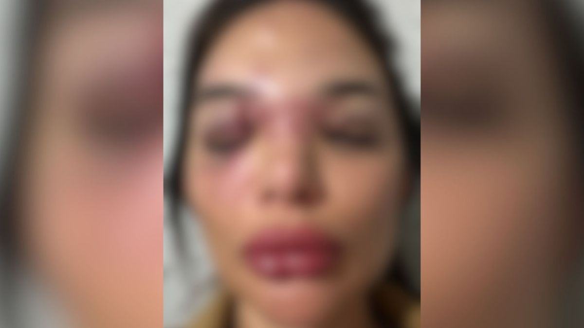 Veja depoimento de mulher agredida por empresário em São Paulo