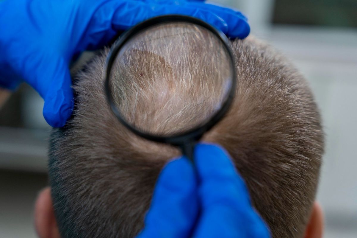 Cabelo não cresce de dentro para fora, mas é puxado para cima, diz estudo