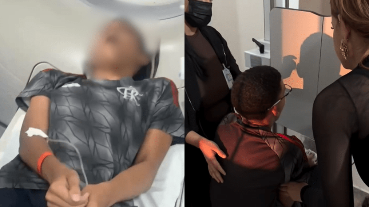 Jovem vai parar na emergência após bocejar e mandíbula sair do lugar; caso ocorreu em Brasília