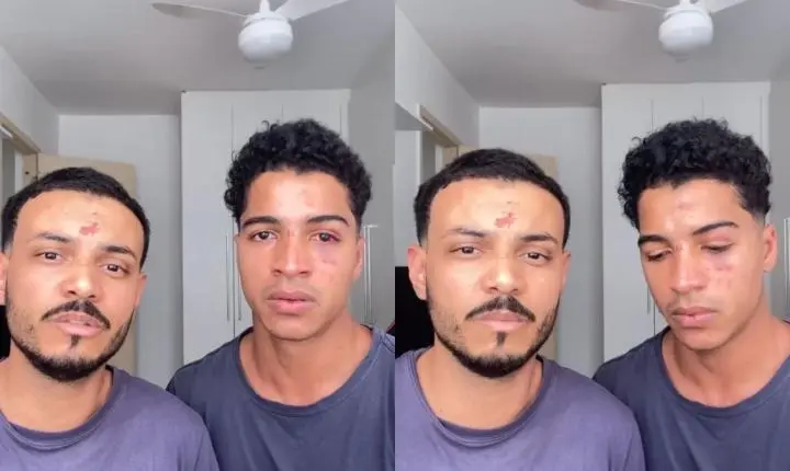 Jovens relatam ataque homofóbico após festa universitária no RJ