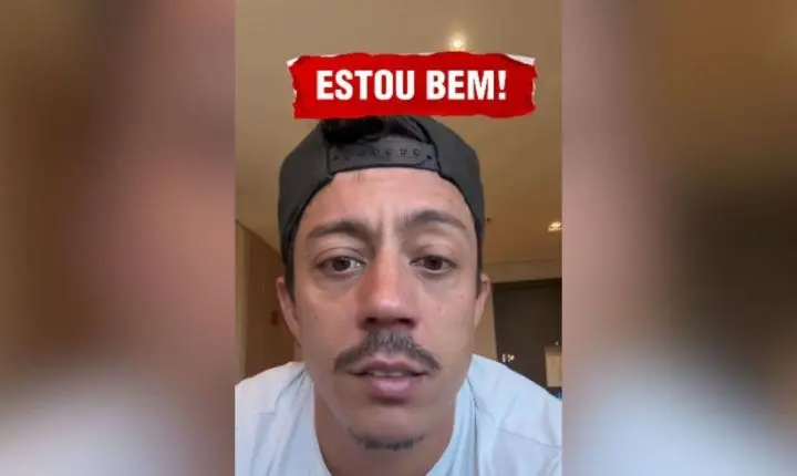 Paralisia de Bell: veja famosos que tiveram o quadro, além de Renato Albani